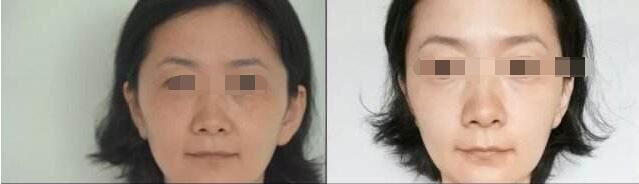 黄月婷